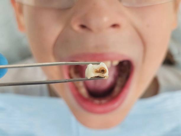 Best Broken or Chipped Tooth Repair in Carefree, AZ